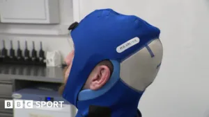 Revolutionizing Concussion Treatment in Rugby Union with PolarCap Innovation